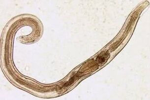 The parasites of the cutting man