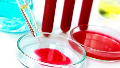 Blood test