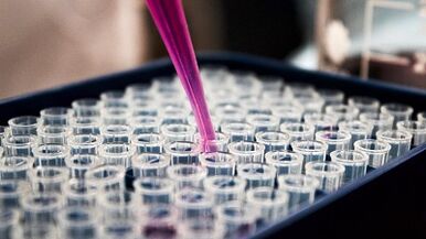 How to perform tests to detect parasites in the body